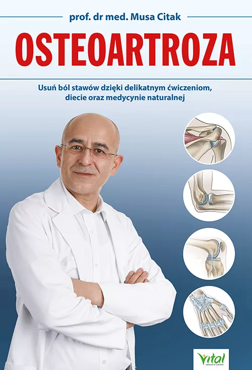 Osteoartroza - Musa Citak - 7016