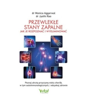 Przewlekłe stany zapalne – jak je rozpoznać i wyeliminować - Jyothi Rao, Monica Aggarwal - 7168