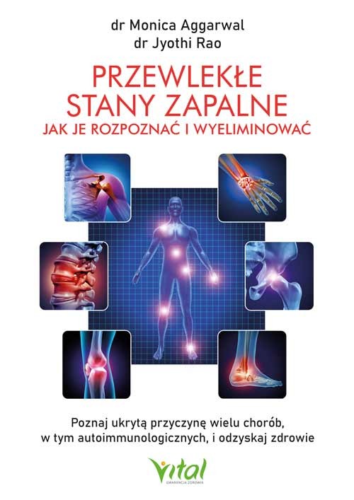 Przewlekłe stany zapalne – jak je rozpoznać i wyeliminować - Jyothi Rao, Monica Aggarwal - 7168