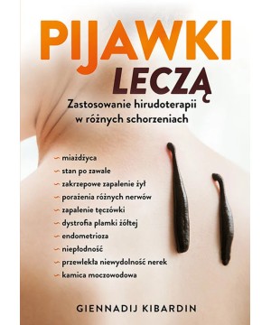 Pijawki leczą. Zastosowanie...