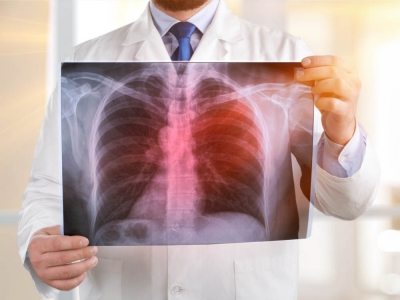 Bakteryjne zapalenia płuc – przegląd