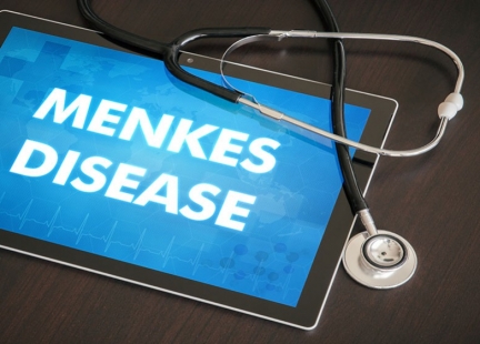 Choroba Menkesa – choroba z niedoboru miedzi